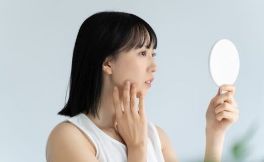肌荒れが気になる女性
